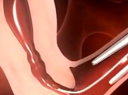 试管婴儿取卵后吃什么可以利尿？蔬菜和水果不能少