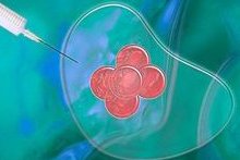 上海崇明区做试管婴儿的医院有哪些？