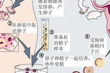 2026南平市最新男性陪产假有多少天？试管婴儿可以增加产假吗？